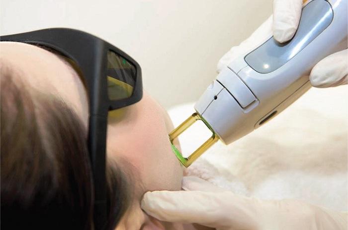 KAYA UNVEILS KAYA ULTIMA LASER HAIR REMOVAL IN UAE; SETS BENCHMARK WITH NEW  TECHNOLOGY